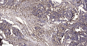 RB3 antibody