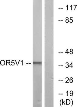 Olfactory receptor 5V1 rabbit pAb Antibody