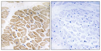 MIA rabbit pAb Antibody