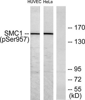 SMC1 (phospho-Ser957) antibody