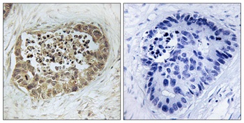 SMC1 (phospho Ser966) rabbit pAb