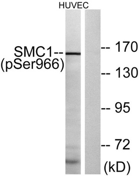 SMC1 (phospho-Ser966) antibody