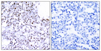 SMC1 rabbit pAb