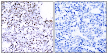 SMC1 antibody