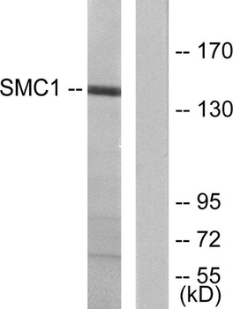 SMC1 rabbit pAb