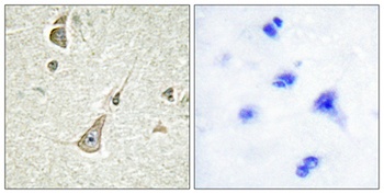 Protocadherin-11 antibody