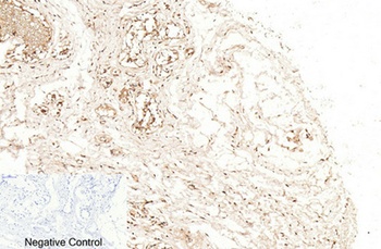 Cleaved-Caspase-1 (D210) antibody