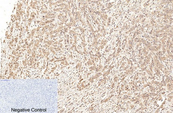 Cleaved-Caspase-1 (D210) antibody