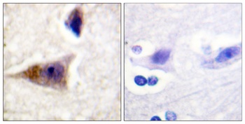 Caspase-1 (phospho Ser376) rabbit pAb