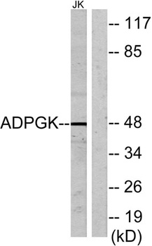ADP-GK rabbit pAb Antibody