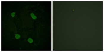 Histone H3 (Acetyl Lys14) antibody