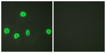 Histone H3 (Acetyl Lys18) antibody