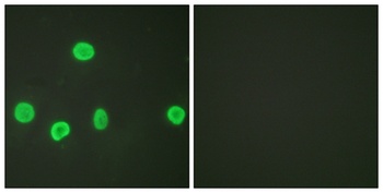Histone H3 (Acetyl Lys18) rabbit pAb