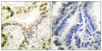 Histone H3 (Acetyl Lys18) rabbit pAb