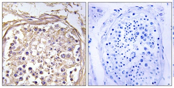 CHST9 antibody