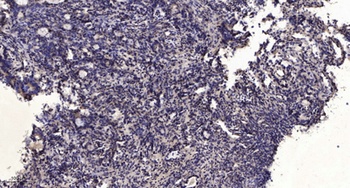 RIOK1 rabbit pAb Antibody