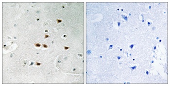 AIP4 (phospho Tyr420) rabbit pAb