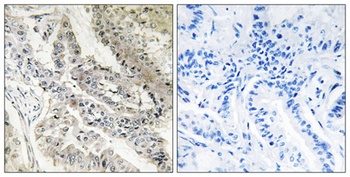 CRBP-III rabbit pAb
