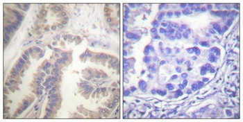Caspase-6 (phospho Ser257) rabbit pAb