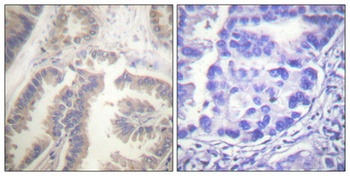 Caspase-6 (phospho-Ser257) antibody