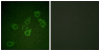 Caspase-6 (phospho Ser257) rabbit pAb