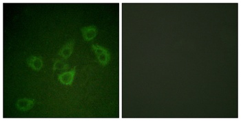 Caspase-6 (phospho-Ser257) antibody