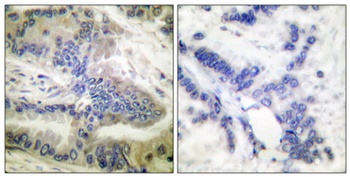 Caspase-6 (phospho Ser257) rabbit pAb
