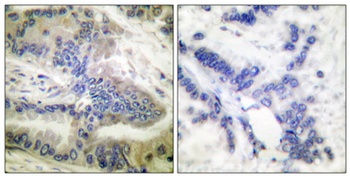 Caspase-6 (phospho-Ser257) antibody