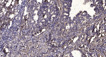 Neurocalcin δ rabbit pAb