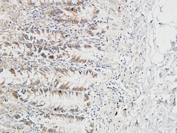 Reg IV antibody