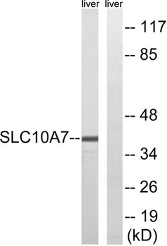 SLC10A7 rabbit pAb