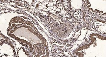 SLC10A7 antibody