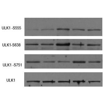 ULK1 rabbit pAb