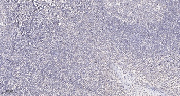 ULK1 rabbit pAb