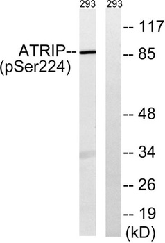 ATRIP (phospho Ser224) rabbit pAb