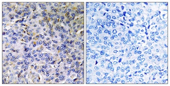 ACAD-11 rabbit pAb