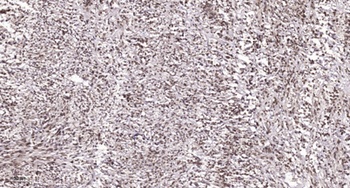 Caspase-9 (phospho-Ser196) antibody