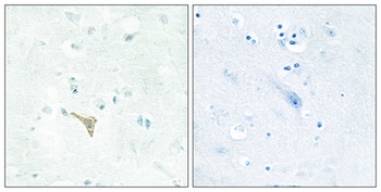 RECK antibody