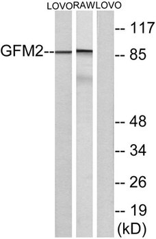 EF-G2 antibody