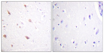 NIFK (phospho Thr234) rabbit pAb