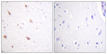 NIFK (phospho-Thr234) antibody