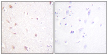 NIFK antibody