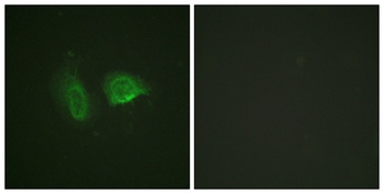 CaSR (phospho Thr888) rabbit pAb