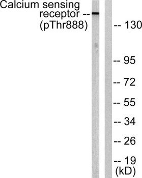 CaSR (phospho-Thr888) antibody