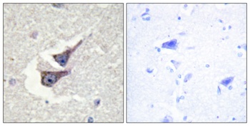 Catalase (phospho-Tyr386) antibody