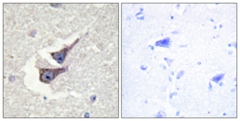 Catalase (phospho Tyr386) rabbit pAb