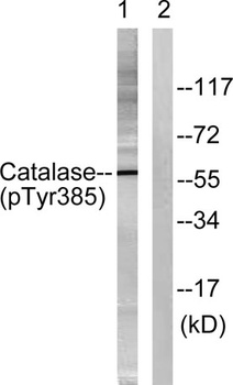 Catalase (phospho Tyr386) rabbit pAb