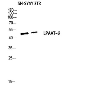 LPAAT-Theta antibody