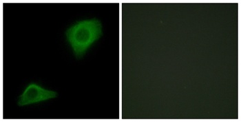 LPAAT-Theta antibody