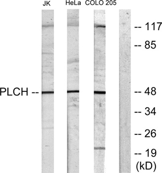 LPAAT-Theta antibody